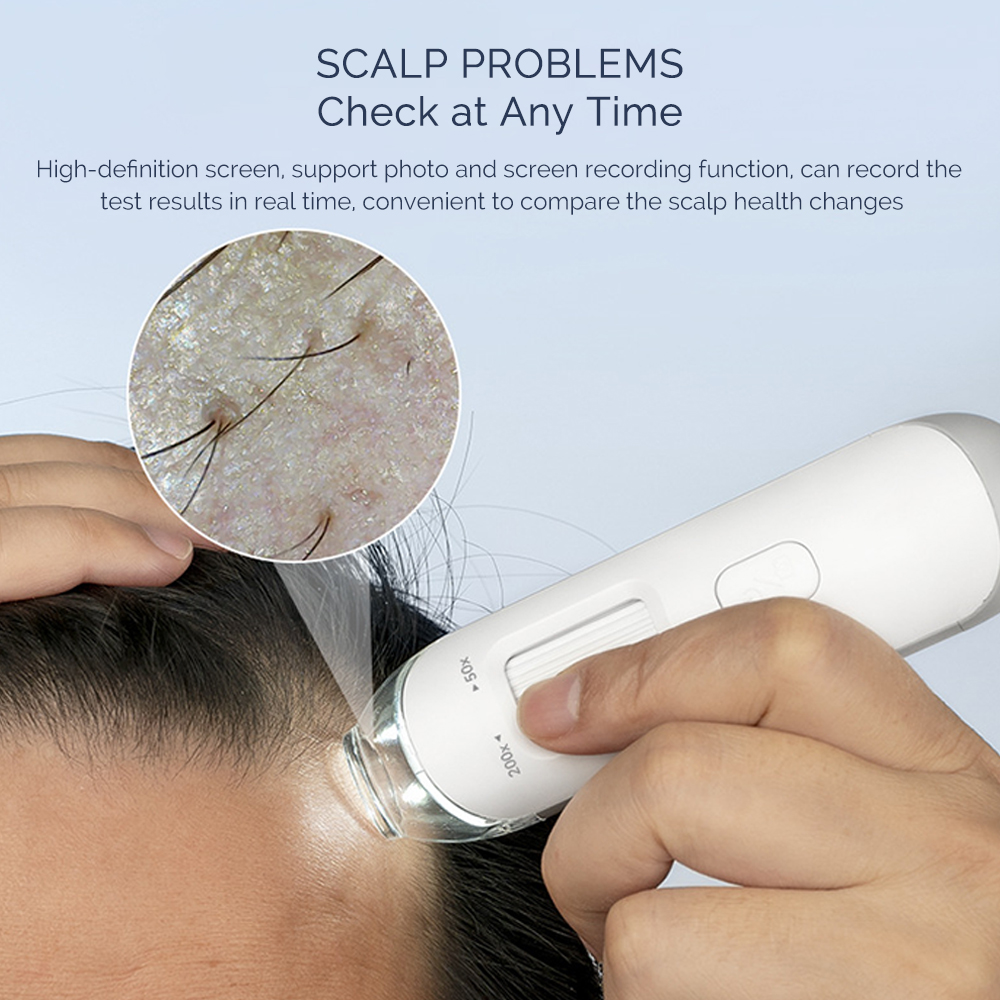 Visual Dermatoscope Scalp Dete - Electronics Quiz ulasan dan harga
