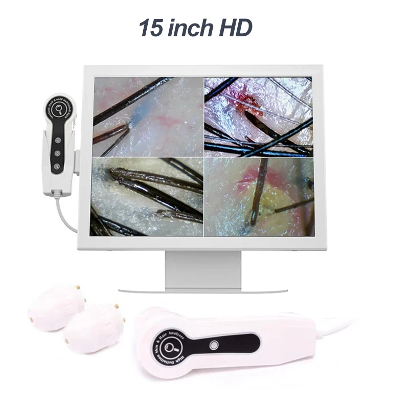 2025 HD Digital Skin Analyzer  - Electronics Quiz ulasan dan harga