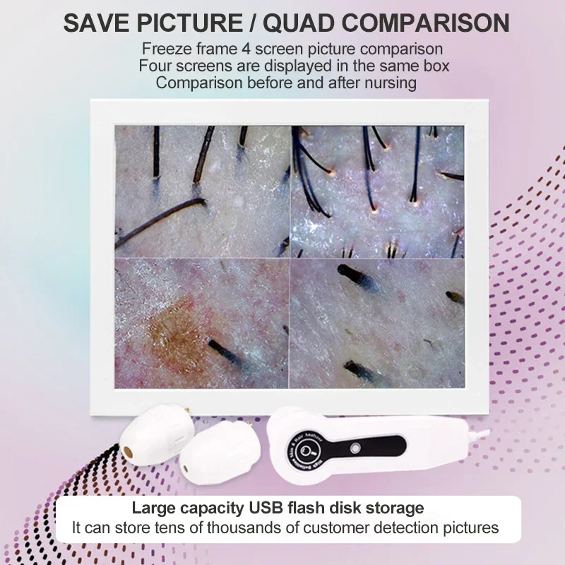 2025 HD Digital Skin Analyzer  - Electronics Quiz ulasan dan harga